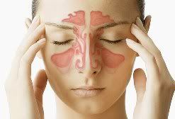 sphenoid sinus